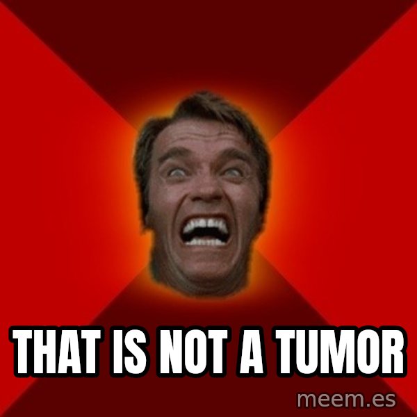 Angry Arnold meme: that is not  a tumor