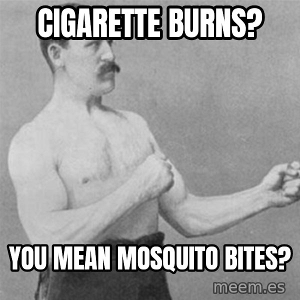 overly manlyman meme: cigarette burns? / You mean mosquito bites?
