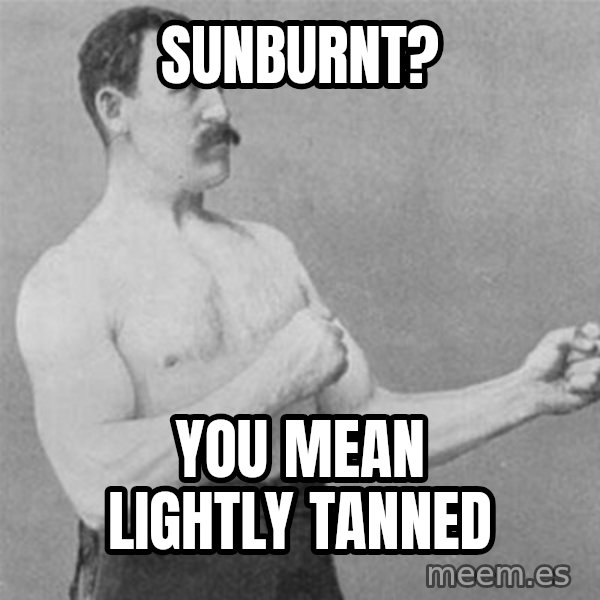 overly manlyman meme: sunburnt? / you mean lightly tanned
