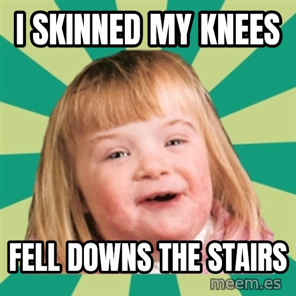 Retard girl meme: I skinned my knees / Fell downs the stairs